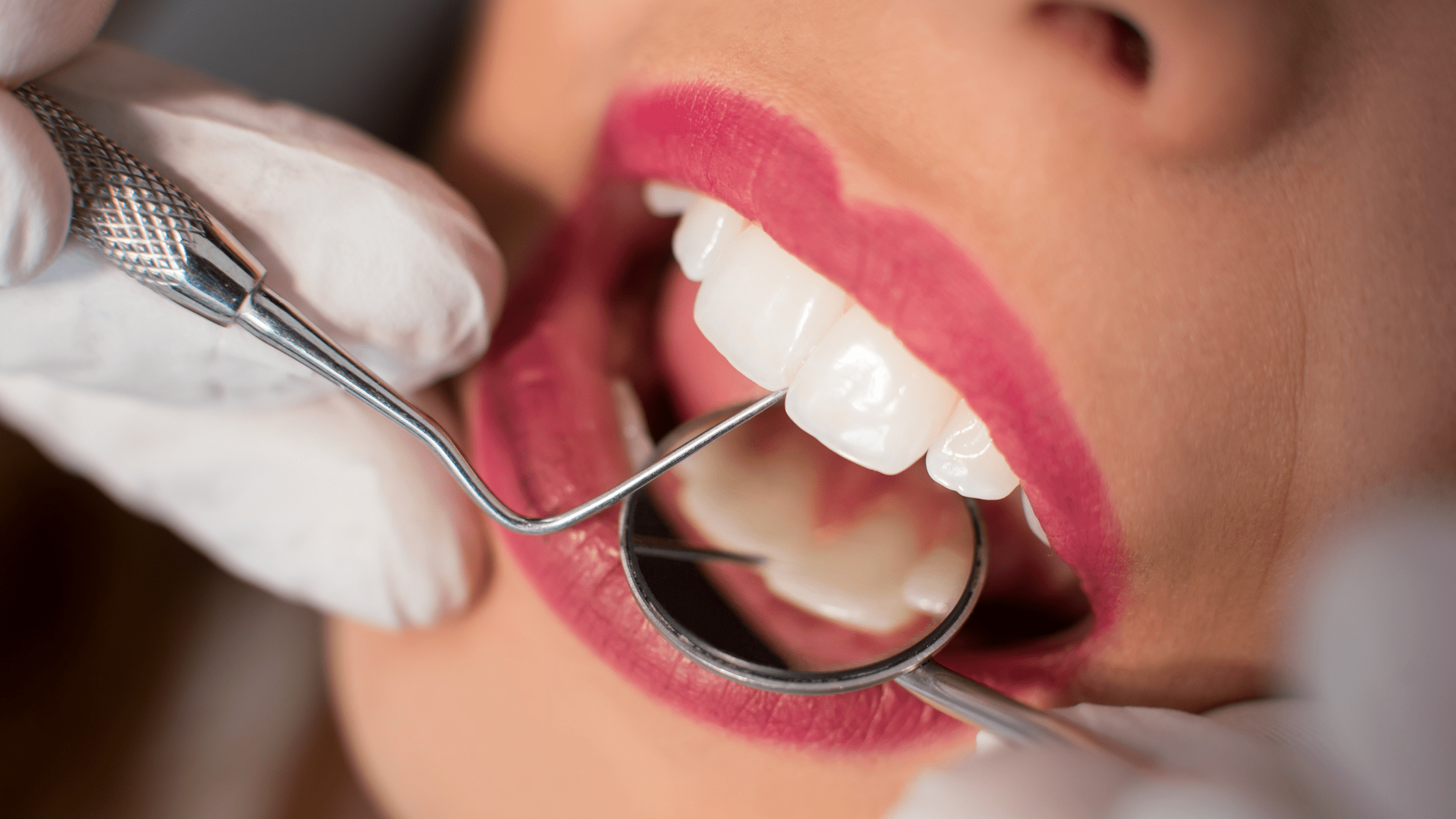 Plaque and tartar: how to prevent buildup on teeth 🦷