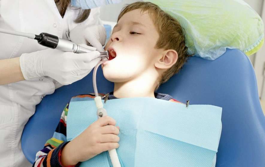 Dental sealants for kids